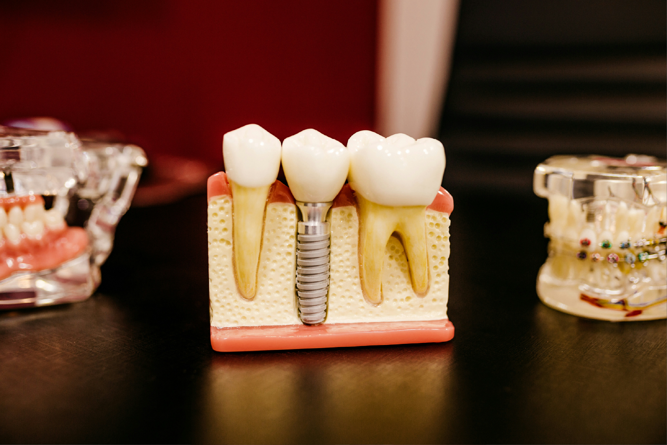 Bone Graft and Membrane